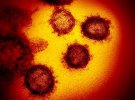 Визуально COVID-19 похож на возбудитель атипичной пневмонии коронавирусов SARS и MERS