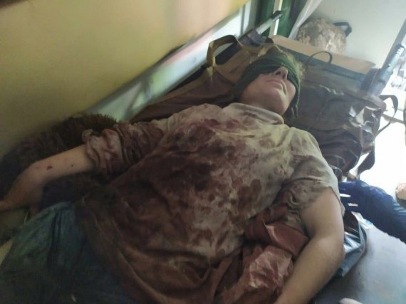 На линии разграничения в Донбассе 35-летняя женщина подорвалась на минном поле боевиков