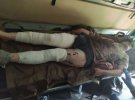 На лінії розмежування на Донбасі  35-річна  жінка  підірвалася на мінному полі бойовиків