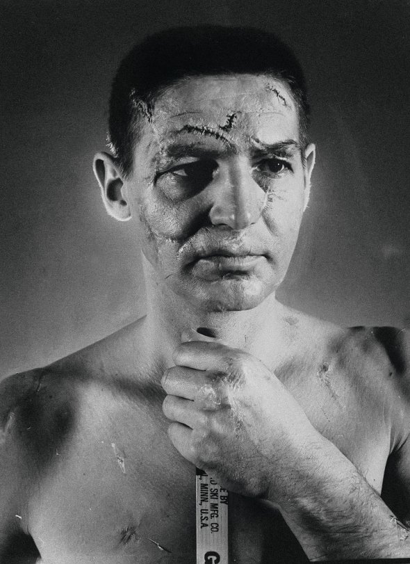 Хокеїста Террі Савчука  1966 року сфотографували для обкладинки американського журналу Life. Тоді ж заради експерименту позначили всі його ушкодження гримом. На обличчі майже не залишилося не вдареного шайбою місця. Порахували рани і стали називати "Людиною 600 шрамів"