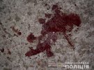 У Вараші патрульні підстрелили пса, який на них накинувся, та поранили його господаря
