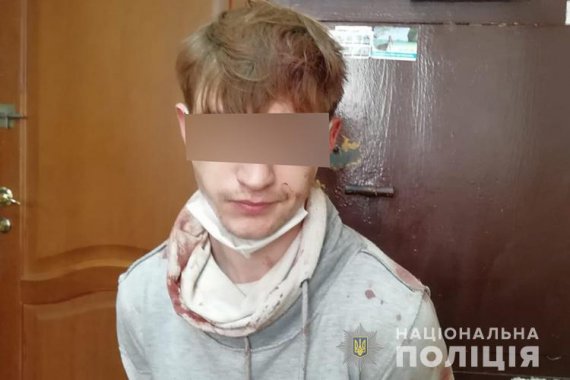 В Тернополе 26-летний мужчина порезал мать и отчима