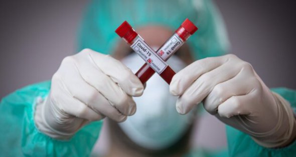 Тест підтвердив коронавірусну інфекцію у всієї родини.
