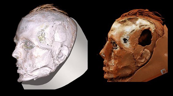 Учені не можуть зняти маску з обличчя, ризикуючи пошкодити його, тому змушені досліджувати муміфіковану голову іншими методами