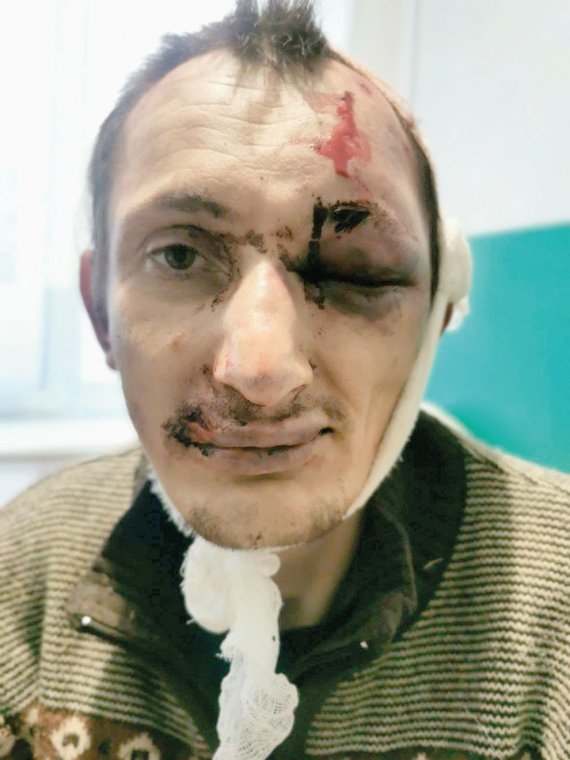 На Черкащині затримали 3-х зловмисників, які напали на 37-річного Євгена  Бекреньова зі  Сміли