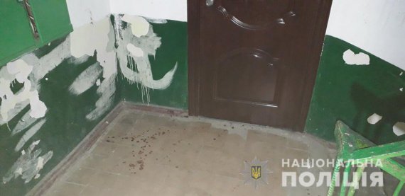 На Одещині в під’їзді багатоповерхівки   37-річний чоловік    захищав вагітну сусідку від її чоловіка і отримав кулю в шию