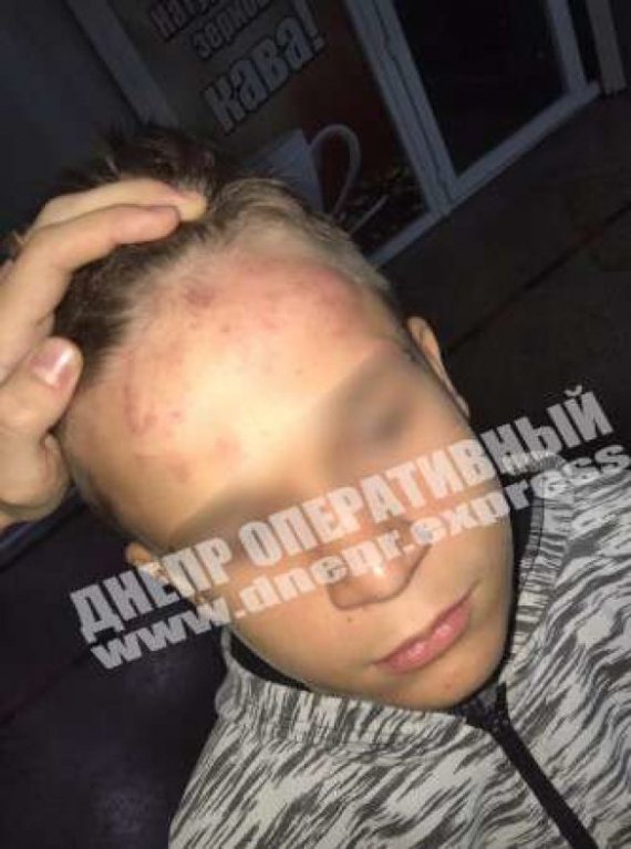 В городе Никополь у школы толпа детей от 8 до 12 лет избила 12-летнего ученика