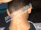 В городе Никополь у школы толпа детей от 8 до 12 лет избила 12-летнего ученика