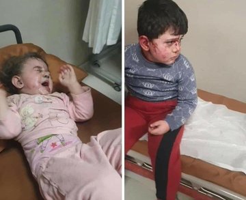 Серед поранених є малолітні діти. Фото: twitter/AzerbaijanMFA