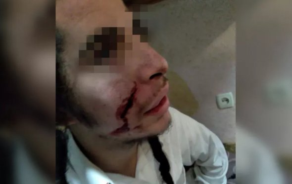 Пострадавший гражданин Израиля