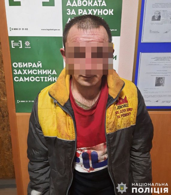 На Миколаївщині 31-річний чоловік намагався вбити свою сім, обливши жінку і двох дітей невідомою хімічною речовиною