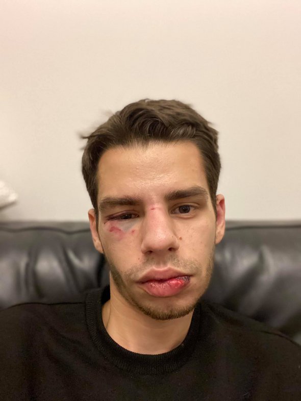 У Львові таксист побив клієнта на очах у перехожих