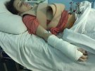 Юлія Павленко-Глущенко  отримала численні переломи під час аварії на зупинці в Києві. Вона саме сідала в припарковане авто, коли її зніс водій  таксі