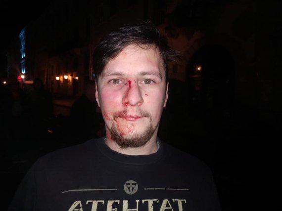 Андрій Мочурад після нападу