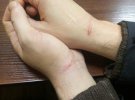 У Києві обирають запобіжний захід волонтерові Сергію Бутку. Його підозрюють у вбивстві 30-річної жінки в Голосіївському лісі