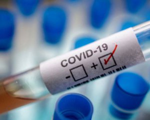 Украина не будет покупать российскую вакцину от Covid-19