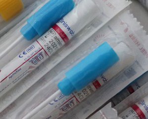 Коронавирус, грипп, корь: украинские ученые разработали уникальный тест на выявление инфекций