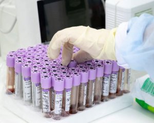 Коронавірус в Україні: як змінилися цифри за вихідні