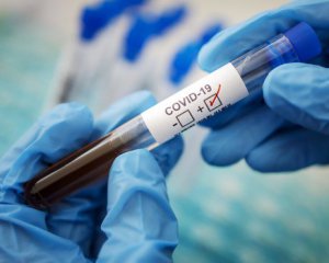 Розроблено тест, який буде виявляти коронавірус за 10 секунд
