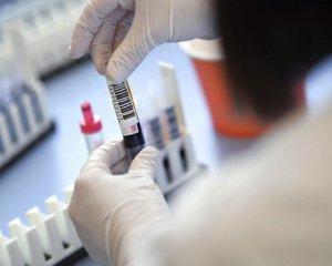 У Японії виявили нову мутацію коронавірусу