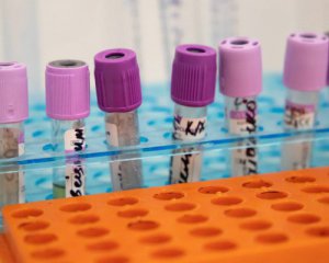 Як змінилися коронавірусні цифри за останню добу