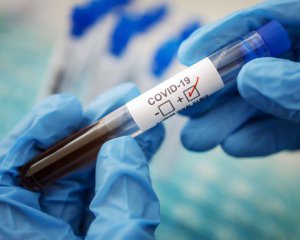Скоро результати тестів на коронавірус з України перестануть приймати в інших країнах