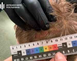 Скандал із катуванням у поліції: що розповів потерпілий