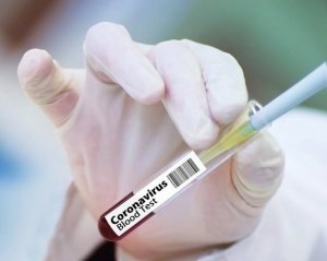 Украина ожидает почти полмиллиона доз вакцины от Covid-19