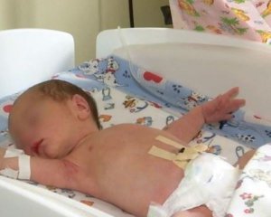Розповіли про стан немовляти, якого знайшли в поліетилені біля колій