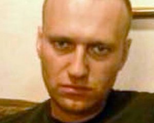 Російські лікарі не побачили загрози життю Навального