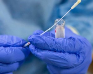 Є загроза "вибухового зростання" захворюваності на Covid-19