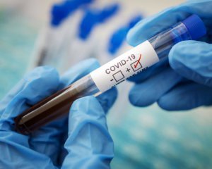 99% смертей від Covid-19 припадає на не повністю вакцинованих - дослідження