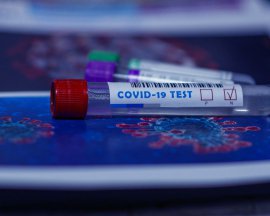У хворих на коронавірус значно вищий ризик ураження нирок - дослідження