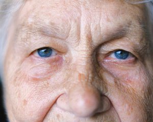 Забудькуватість та дезорієнтація: які симптоми вказують на хворобу Альцгеймера