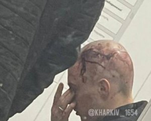 ДТП в Харькове: отец задержанного подростка &quot;нашел&quot; виновных