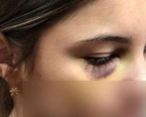 13-річний борець жорстоко познущався з дівчини у школі