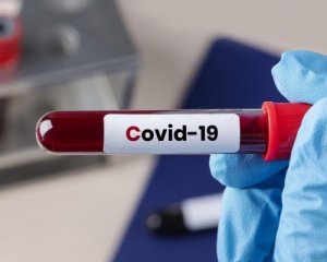 Всесвітній рекорд. У США на Covid-19 захворіли понад мільйон людей за день