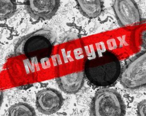 Зараження буде: у МОЗ розповіли про ймовірність спалаху мавпячої віспи в Україні