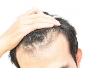 Что влияет на выпадение волос у мужчин: китайские ученые шокировали открытием