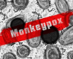 Украина получила вакцину против обезьяньей оспы: кому важно привиться