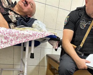Зламали ніс та вибили зуби: у Києві підлітки побили пенсіонера-охоронця за зауваження