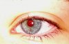 Почему эффект красных глаз на фото может быть хорошим знаком