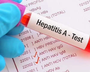 Гепатит А атакує Київ: що відомо про спалах і джерело зараження