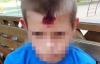 Військовий відкрив вогонь на дитячому майданчику: поранено хлопчика