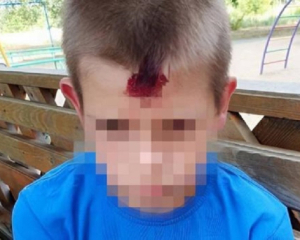 Військовий відкрив вогонь на дитячому майданчику: поранено хлопчика