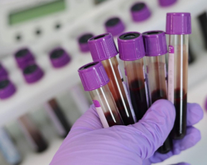 У Львові у ліцеї через спалах гострої кишкової інфекції кількість хворих зросла до 23