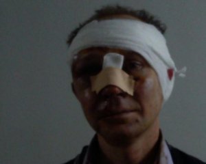 Работника ИТ-безопасности жестоко избили