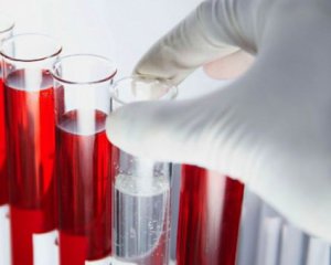 Хвороби старості визначають за аналізом крові у молоді