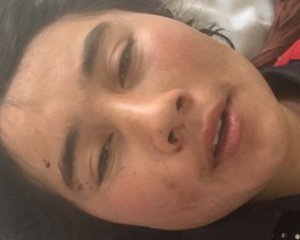 Ревнивий чоловік відрізав дружині вуха