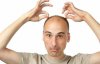 Ученые рассказали, какие мужчины лысеют самыми первыми